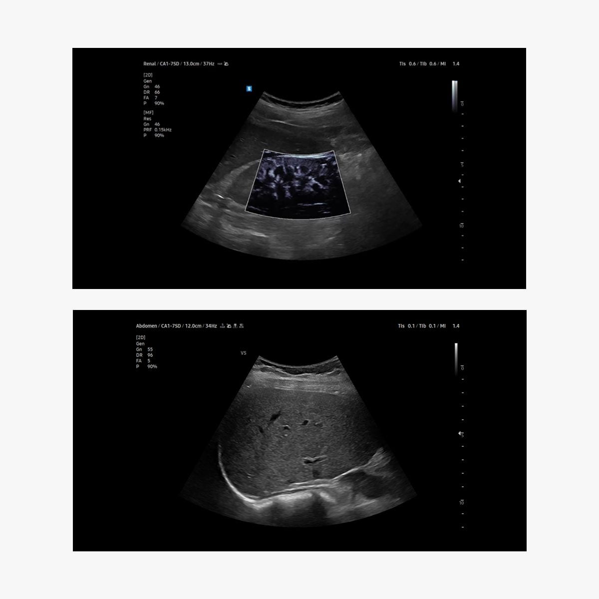 V5 – Ultrasonido ginecológico