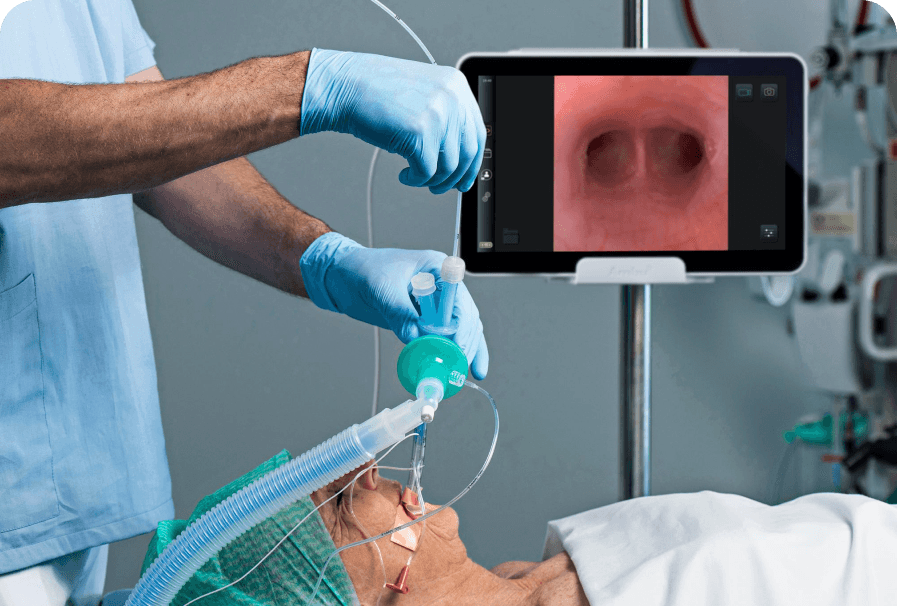 Visualización portátil para endoscopia
