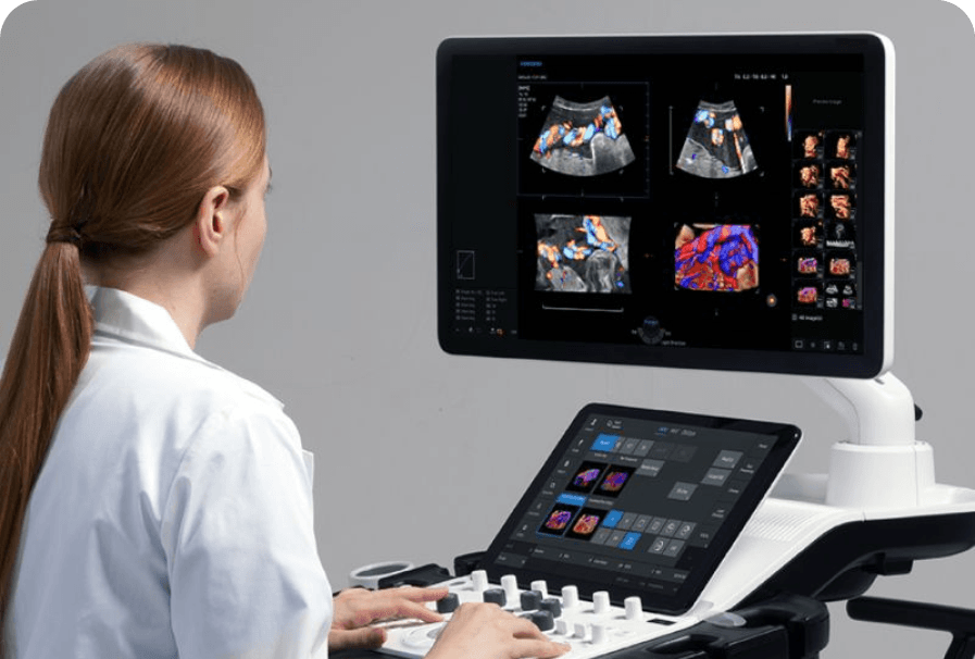 Ultrasonido ginecológico para consulta